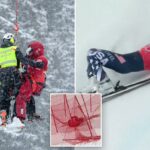 Lindsey Vonn se machucou após acidente na última corrida de downhill na semana antes dos Jogos Olímpicos de Inverno de 2026