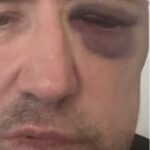 DJ Fat Tony ficou inconsciente depois de levar dois socos brutais na cabine do DJ antes de tocar