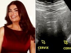 Mulher teve períodos intensos. Após a cirurgia aos 19 anos, ela descobriu que tem uma condição extremamente rara – 2 úteros (exclusivo) Ellie Curran SWNS