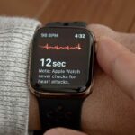 ECG Apple Watch