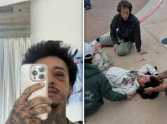 Nyjah Huston fratura crânio e cavidade ocular após falha no truque de skate Nyjah Huston fratura o crânio insta 5