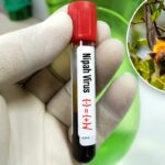 Mão enluvada segurando um tubo de amostra de sangue rotulado