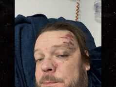 ‘Pawn Stars’ Corey Harrison hospitalizado após Crash, vai perder o casamento do papai Corey-Harrison-main-ig-1