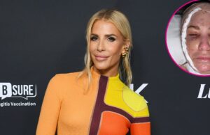 Tracy Tutor Compartilha Selfie Enfaixada Após Pescoço E Facelift: ‘Dor E Inchaço’ Listagem de milhões de dólares, Tracy Tutor mostra seu rosto enfaixado e machucado em uma foto em progresso após o pescoço e o lifting facial