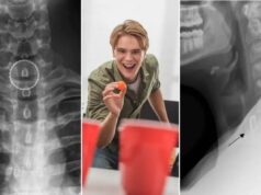 A lesão bizarra de beer pong de um jovem de 19 anos exigiu cirurgia para consertar Cinco colegas de trabalho jogando beer pong no escritório depois do trabalho.