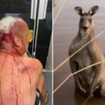 Australiano tem 'sorte de estar vivo' após ser espancado em violento ataque de canguru