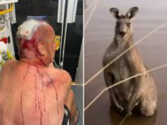 Australiano tem ‘sorte de estar vivo’ após ser espancado em violento ataque de canguru Australiano tem 'sorte de estar vivo' após ser espancado em violento ataque de canguru