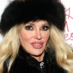 Brandi Glanville diz que parasita facial e desfiguração foram causados ​​por implantes mamários danificados