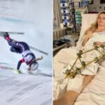 Enquanto Lindsey Vonn enfrenta uma longa recuperação, este é o preço que as Olimpíadas cobram do corpo dos atletas