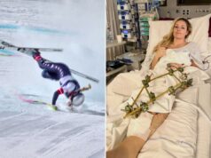 Enquanto Lindsey Vonn enfrenta uma longa recuperação, este é o preço que as Olimpíadas cobram do corpo dos atletas Enquanto Lindsey Vonn enfrenta uma longa recuperação, este é o preço que as Olimpíadas cobram do corpo dos atletas