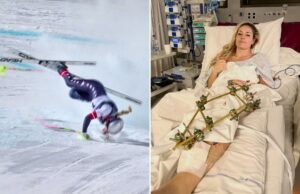Enquanto Lindsey Vonn enfrenta uma longa recuperação, este é o preço que as Olimpíadas cobram do corpo dos atletas Enquanto Lindsey Vonn enfrenta uma longa recuperação, este é o preço que as Olimpíadas cobram do corpo dos atletas
