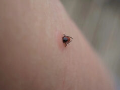 Família dos EUA emite alerta quando homem é acometido de uma doença chocante: ‘Ele perdeu o uso dos braços e ombros’ Yahoo news home