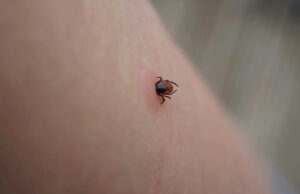 Família dos EUA emite alerta quando homem é acometido de uma doença chocante: ‘Ele perdeu o uso dos braços e ombros’ Yahoo news home