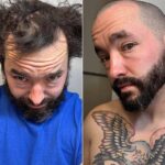 Um usuário do fórum Reddit r/bald mostra sua transformação impressionante depois de raspar o cabelo ralo