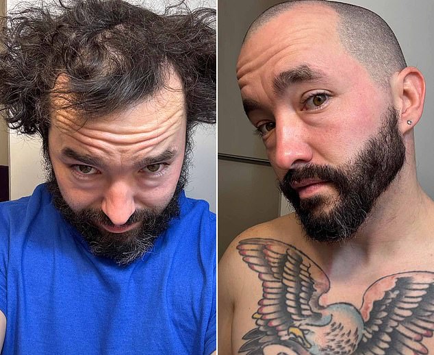 Heróis sem pelos! Dentro da comunidade on-line onde homens carecas Um usuário do fórum Reddit r/bald mostra sua transformação impressionante depois de raspar o cabelo ralo
