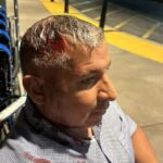 Homem baleado na cabeça com bala 'menos que letal' no protesto do ICE na Califórnia foi vítima de força excessiva, afirma o processo