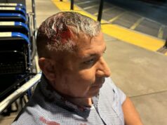 Homem baleado na cabeça com bala ‘menos que letal’ no protesto do ICE na Califórnia foi vítima de força excessiva, afirma o processo Homem baleado na cabeça com bala 'menos que letal' no protesto do ICE na Califórnia foi vítima de força excessiva, afirma o processo