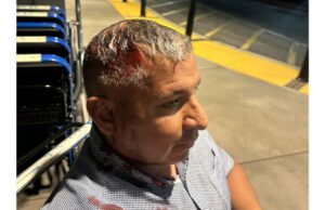 Homem baleado na cabeça com bala ‘menos que letal’ no protesto do ICE na Califórnia foi vítima de força excessiva, afirma o processo Homem baleado na cabeça com bala 'menos que letal' no protesto do ICE na Califórnia foi vítima de força excessiva, afirma o processo