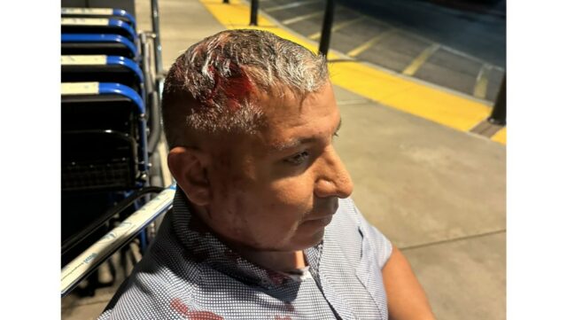 Homem baleado na cabeça com bala 'menos que letal' no protesto do ICE na Califórnia foi vítima de força excessiva, afirma o processo
