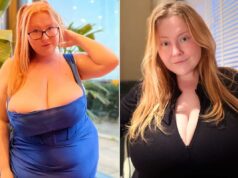 Mulher de 39 libras. Os seios não param de crescer devido a uma condição rara – que ela descobriu enquanto tomava Mounjaro Tiana Lua. Tianna Moon / SWNS