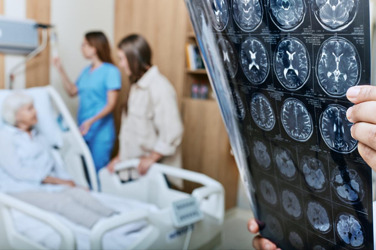 Os sintomas de Alzheimer podem ser previstos com anos de antecedência através de um teste simples