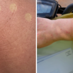 Posties disseram para parar de usar uniformes em meio a relatos de que estão ficando queimados de sol