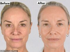 Tamzin Outhwaite, 55, revela os resultados incríveis de seu facelift não cirúrgico de £ 5 mil depois de se sentir deprimida com sua aparência Tamzin Outhwaite disse que se sente 'tão confiante' ao revelar os resultados surpreendentes de seu tratamento de lifting não cirúrgico de £ 4.950 na terça-feira
