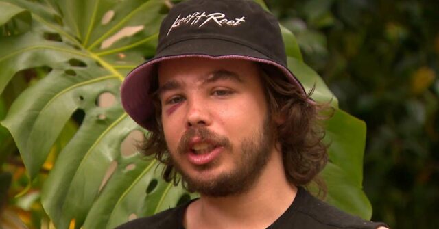 Um tradie de Melbourne ficou com ferimentos graves no rosto depois de ser atacado por um piloto de e-scooter em um incidente de violência no trânsito. Tyler Macaloney estava voltando para casa depois de seu trabalho de espancamento em Parkville na sexta-feira, quando foi confrontado por um homem que entrava e saía do trânsito.