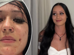 ‘Uma luta infernal’: atualização da família após esfaqueamento no clube 'Uma luta infernal': atualização da família após esfaqueamento no clube