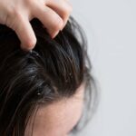 4 dicas Merawat Kulit Kepala, Cara Sederhana Cegah Ketombe e Bikin Rambut Lebih Sehat