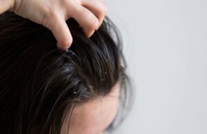 4 dicas Merawat Kulit Kepala, Cara Sederhana Cegah Ketombe e Bikin Rambut Lebih Sehat 4 dicas Merawat Kulit Kepala, Cara Sederhana Cegah Ketombe e Bikin Rambut Lebih Sehat