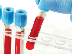 78% da população urbana está exposta a resíduos de pesticidas e toxinas: pesquisa 78% da população urbana está exposta a resíduos de pesticidas e toxinas: pesquisa