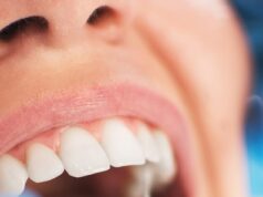 ALEXANDRA SHULMAN: Cuidado com o novo comércio fraudulento em atendimento odontológico. Um dentista tentou me cobrar £ 50.000 por esse pequeno problema (que foi resolvido sozinho). Aqui estão novos truques e táticas a serem observados Opto por economizar meu dinheiro para experiências mais agradáveis do que aquilo que suspeito estar se tornando um comércio fraudulento de cuidados com os dentes. escreve Alexandra Shulman