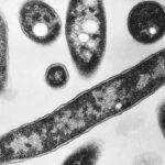 Doença dos legionários