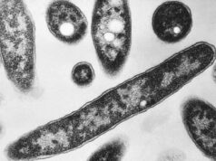 Alerta de saúde urgente após surto de doença respiratória grave em Melbourne Doença dos legionários