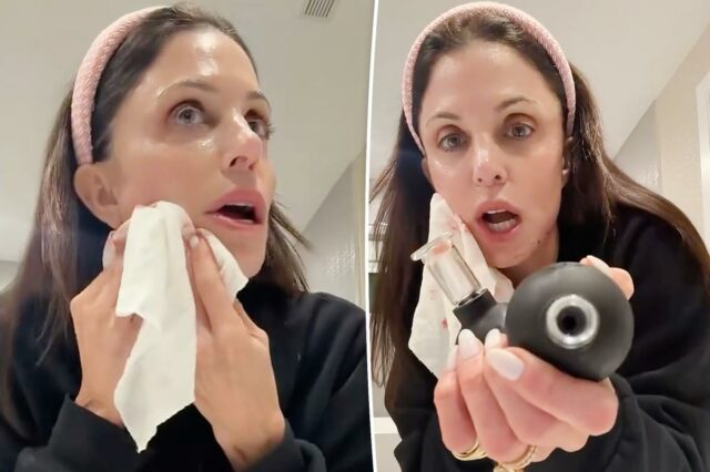 Bethenny Frankel abre o rosto com um instrumento de beleza comprado nas redes sociais: 'Estou pirando'
