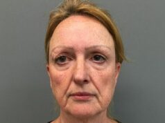 Este procedimento de “aparência natural” transformou minha papada flácida e caída e minhas bochechas encovadas e me fez parecer anos mais jovem. Agora, as pessoas ficam chocadas quando eu lhes digo minha idade REAL Ellen Palmer antes de seu facelift plano profundo, realizado pelo Dr. Yannis Alexandrides