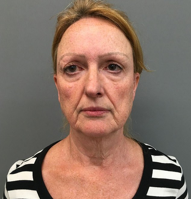 Este procedimento de “aparência natural” transformou minha papada flácida e Ellen Palmer antes de seu facelift plano profundo, realizado pelo Dr. Yannis Alexandrides