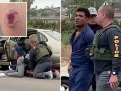 Foto vil mostra uma marca de mordida horrível em um oficial do ICE depois que um suposto gangster de Tren de Aragua o atacou Foto vil mostra uma marca de mordida horrível em um oficial do ICE depois que um suposto gangster de Tren de Aragua o atacou