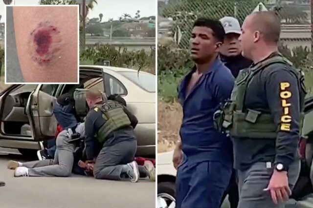 Foto vil mostra uma marca de mordida horrível em um oficial do ICE depois que um suposto gangster de Tren de Aragua o atacou
