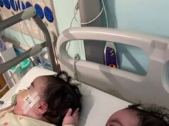 Jesy Nelson revela que filhas gêmeas, de 9 meses, estão sendo tratadas no Great Ormond Street Hospital enquanto ela compartilha uma imagem comovente de suas talas nas pernas durante o tratamento contínuo para SMA Jesy Nelson compartilhou novas fotos de suas filhas gêmeas enquanto elas recebiam um check-up dos médicos do Great Ormond Street Hospital enquanto usavam talas