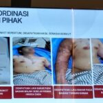 Kasus Penyiraman Air Keras Andrie Yunus Disorot, Koalisi Desak Pengadilan Umum Ungkap Dalang Utama