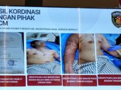 Kasus Penyiraman Air Keras Andrie Yunus Disorot, Koalisi Desak Pengadilan Umum Ungkap Dalang Utama Kasus Penyiraman Air Keras Andrie Yunus Disorot, Koalisi Desak Pengadilan Umum Ungkap Dalang Utama