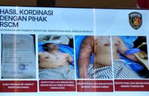 Kasus Penyiraman Air Keras Andrie Yunus Disorot, Koalisi Desak Pengadilan Umum Ungkap Dalang Utama Kasus Penyiraman Air Keras Andrie Yunus Disorot, Koalisi Desak Pengadilan Umum Ungkap Dalang Utama