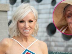 Margaret Josephs, do RHONJ, mostra resultados de plástica no nariz após recuperação brutal Margaret Josephs 58 mostra resultados de plástica no nariz depois de ser machucada e enfaixada