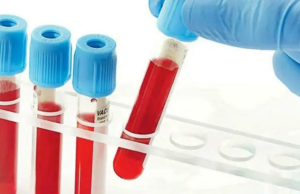 Ministério da Saúde propõe remover testes virais duplicados de hemoderivados Ministério da Saúde propõe remover testes virais duplicados de hemoderivados