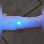 Mulher fica com mancha no dedo e fica chocada com o que acontece sob a luz ultravioleta