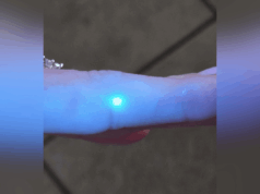 Mulher fica com mancha no dedo e fica chocada com o que acontece sob a luz ultravioleta Mulher fica com mancha no dedo e fica chocada com o que acontece sob a luz ultravioleta