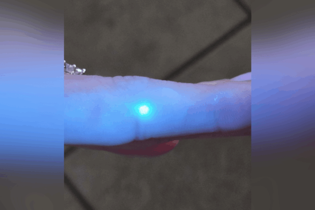 Mulher fica com mancha no dedo e fica chocada com o que acontece sob a luz ultravioleta
