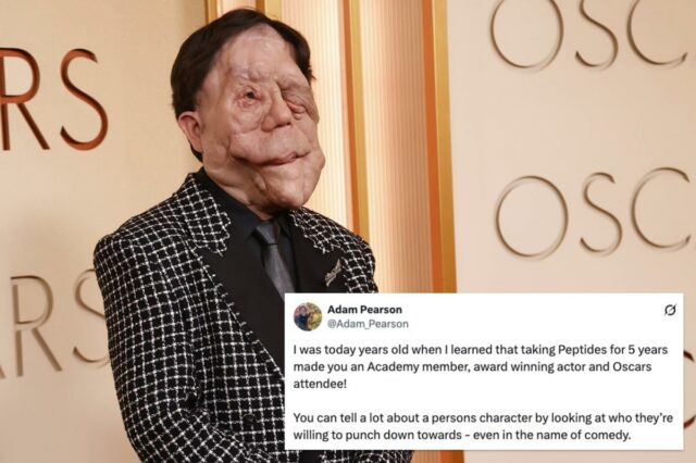 O ator Adam Pearson e os fãs aplaudem o tweet O ator Adam Pearson e os fãs aplaudem o tweet ‘odioso’ do comediante sobre ele
